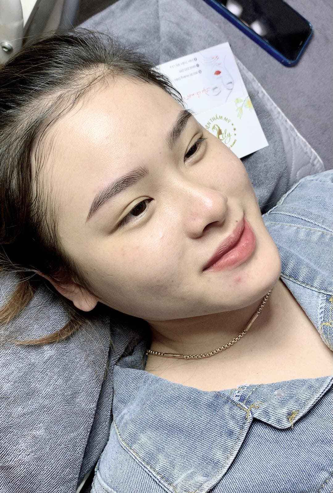 Trước điều trị